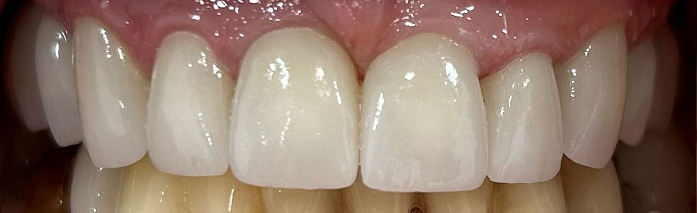 Strona główna - po