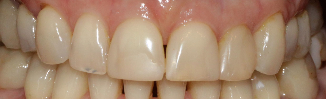 Strona główna - przed