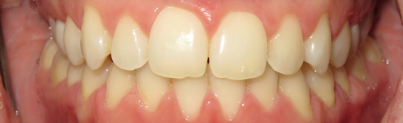 Strona główna - po