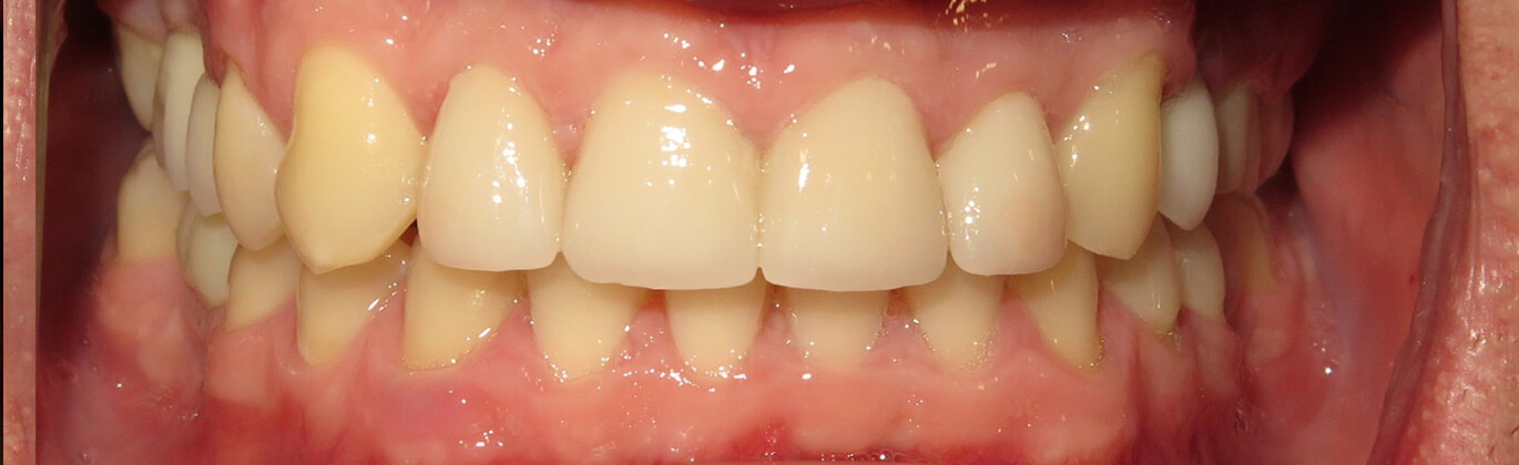 Strona główna - po