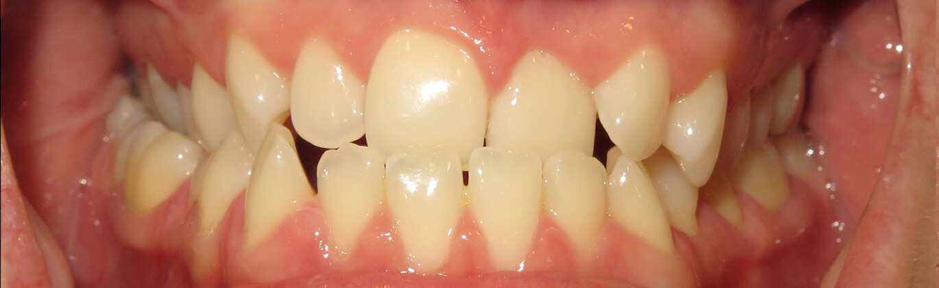 Strona główna - przed