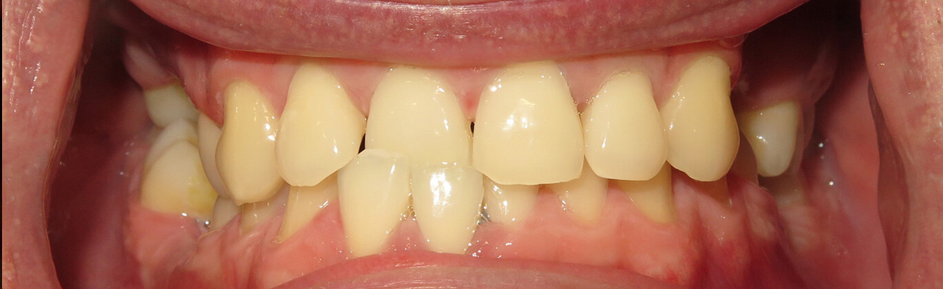 Strona główna - przed